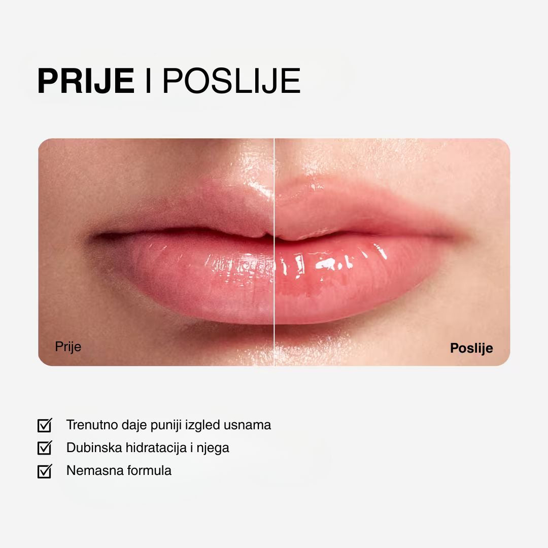 VT Cosmetics Reedle Shot Lip Plumper Beginner